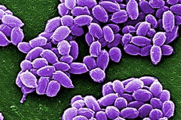 Bacillus Anthracis Spore SEM (Media for Medical)